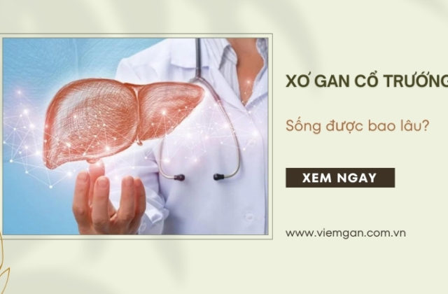 Xơ gan cổ trướng sống được bao lâu? Làm gì để kéo dài tuổi thọ? Xơ gan cổ trướng sống được bao lâu? Làm gì để kéo dài tuổi thọ?