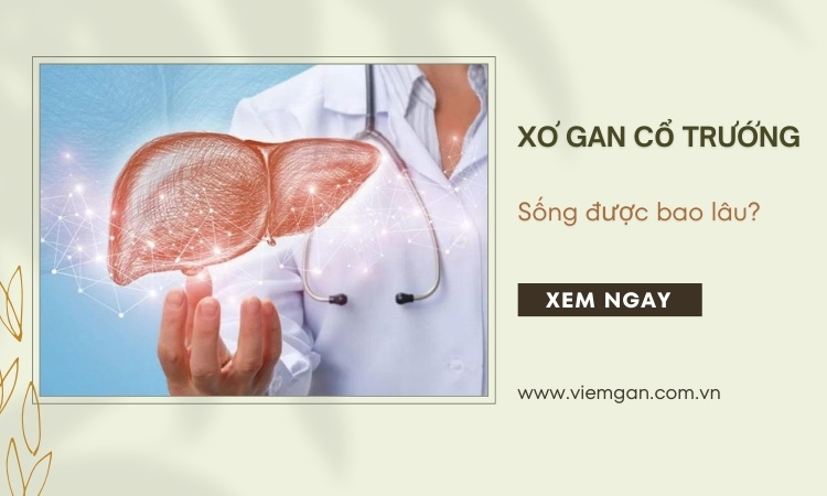 Xơ gan cổ trướng sống được bao lâu? Làm gì để kéo dài tuổi thọ? 1