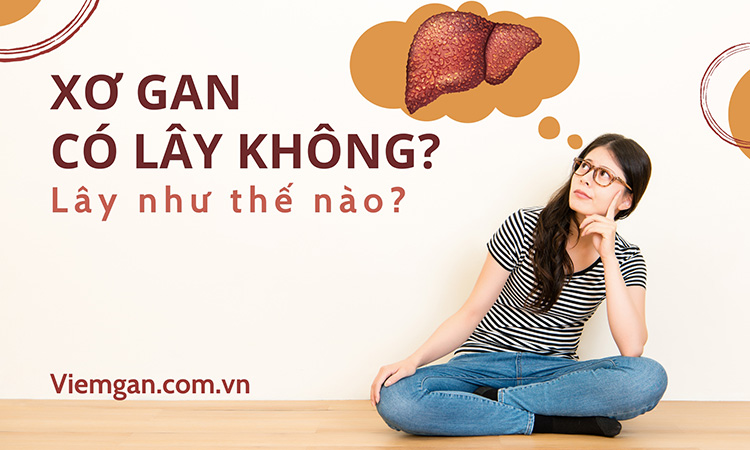 Bệnh xơ gan có lây không và lây qua đường nào? 1 Bệnh xơ gan có lây không và lây qua đường nào? 1