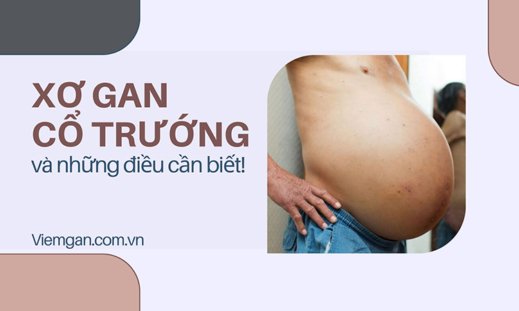 Bệnh xơ gan cổ trướng: nguyên nhân, triệu chứng, điều trị 1