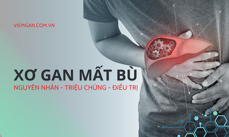 Xơ gan mất bù – Nguyên nhân, triệu chứng, điều trị 1