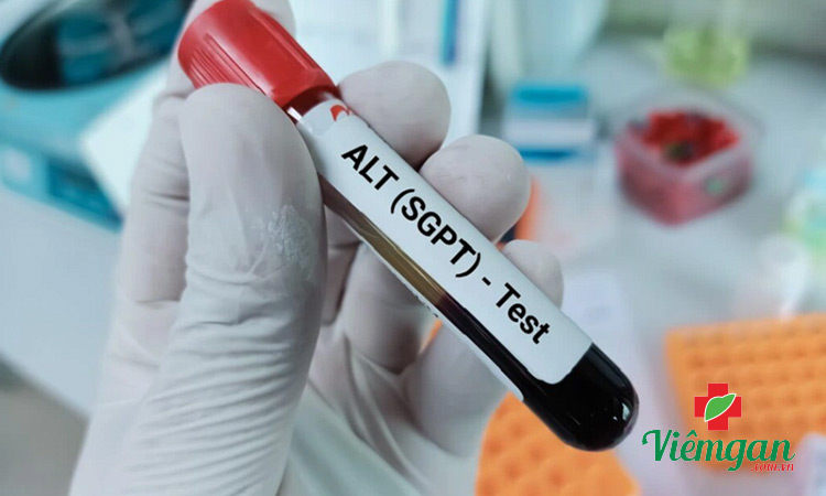 Chỉ số ALT là gì? 1 Chỉ số ALT là gì? 1