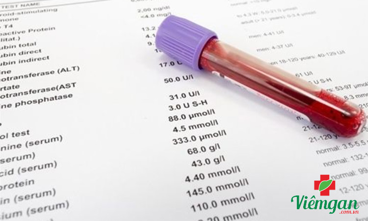 1. Tiêu chuẩn kết luận xơ gan 1 1. Tiêu chuẩn kết luận xơ gan 1