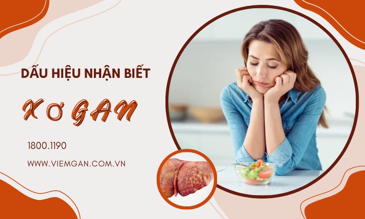 Triệu chứng nhận biết xơ gan còn bù hay đã mất bù 1