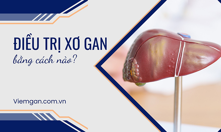 Điều trị xơ gan lựa chọn phương pháp nào tốt nhất? 1