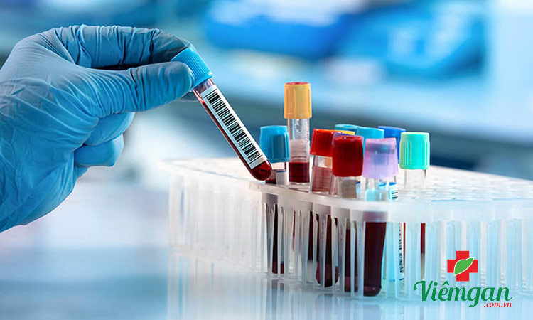 Khi nào chỉ số ALT là thấp? 1 Khi nào chỉ số ALT là thấp? 1