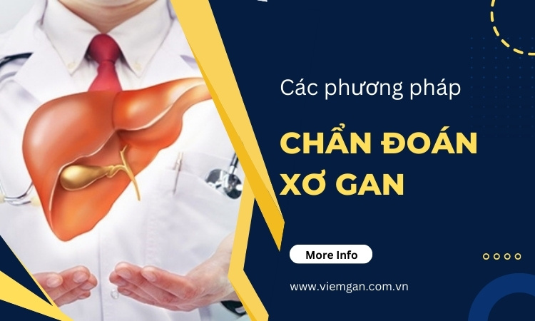 Chẩn đoán xơ gan: tiêu chuẩn đánh giá và các phương pháp! 1 Chẩn đoán xơ gan: tiêu chuẩn đánh giá và các phương pháp! 1