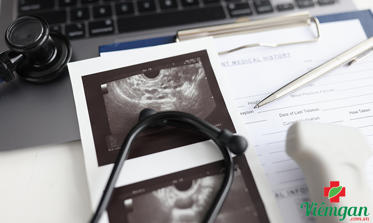 Quy trình thực hiện siêu âm xơ gan 1 Quy trình thực hiện siêu âm xơ gan 1