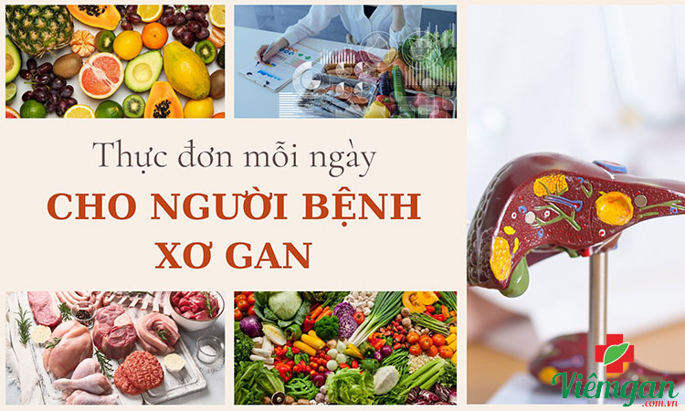Thực đơn mỗi ngày cho người bệnh xơ gan - Xem ngay! 1