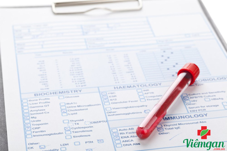 Cách đọc kết quả xét nghiệm HBV-DNA 1