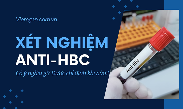 Xét nghiệm Anti-HBc là gì? Được chỉ định khi nào? 1 Xét nghiệm Anti-HBc là gì? Được chỉ định khi nào? 1