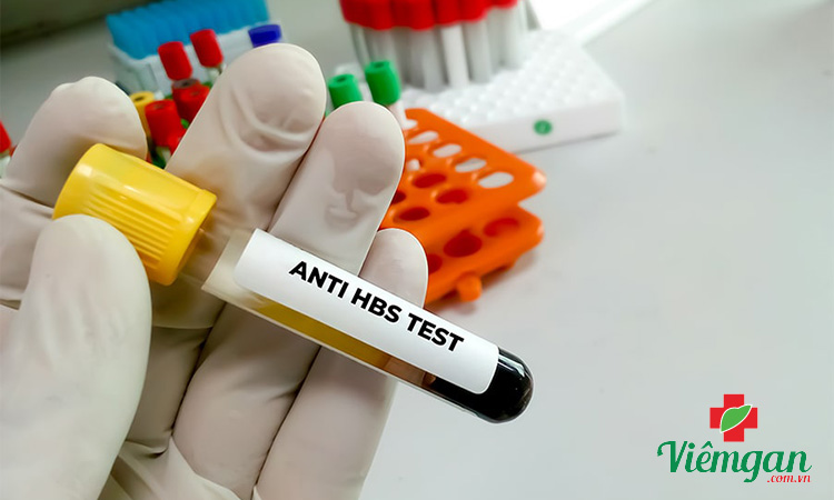 Khi nào chỉ số anti HBs âm tính? 1 Khi nào chỉ số anti HBs âm tính? 1