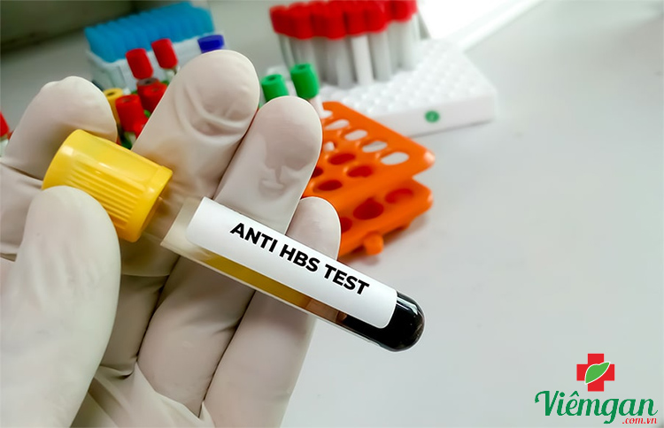 Xét nghiệm Anti Hbs 1