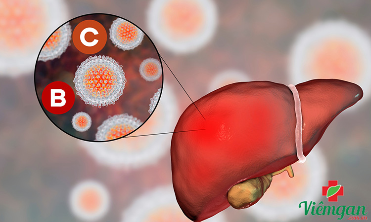 3.5. Điều trị cho các trường hợp đặc biệt 1 3.5. Điều trị cho các trường hợp đặc biệt 1