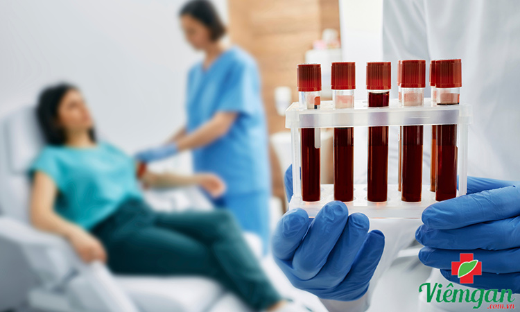 Xét nghiệm Anti-HBc được thực hiện như thế nào? 1 Xét nghiệm Anti-HBc được thực hiện như thế nào? 1