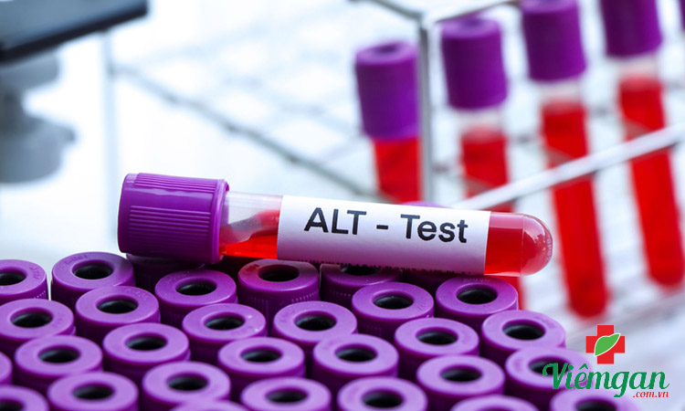 Chỉ số ALT là gì? 1