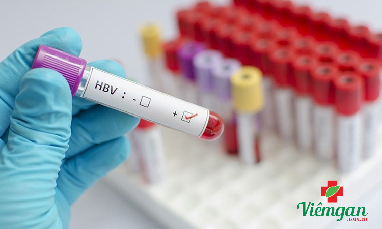 Cách xác định viêm gan B thể ngủ? 1