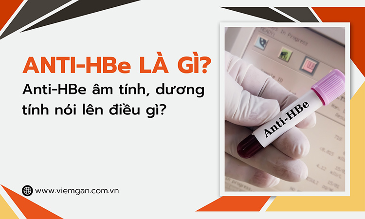 Anti HBe là gì? Anti-HBe âm tính, dương tính nói lên điều gì? 1