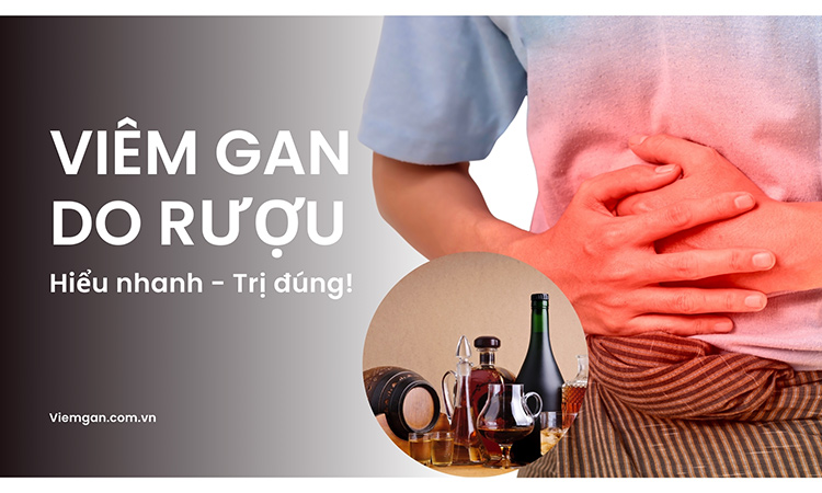 Viêm gan do rượu: Hiểu nhanh - trị đúng 1
