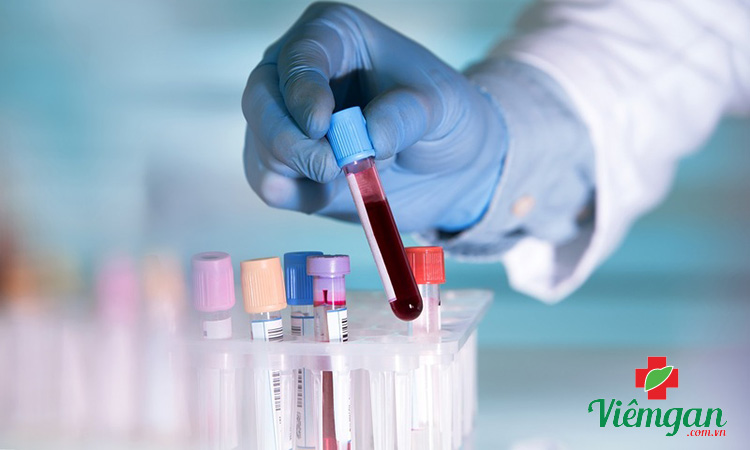 Kiểm tra xét nghiệm kháng thể viêm gan B 1