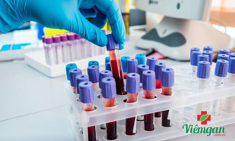 Quy trình thăm khám viêm gan B 1 Quy trình thăm khám viêm gan B 1