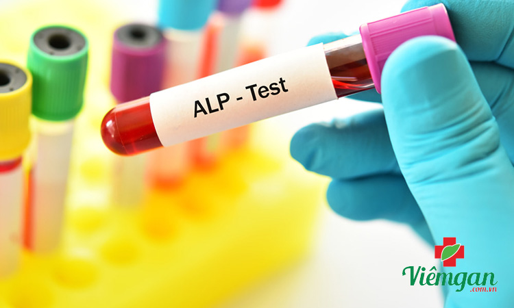 Các chỉ số xét nghiệm chức năng gan 2 Các chỉ số xét nghiệm chức năng gan 2