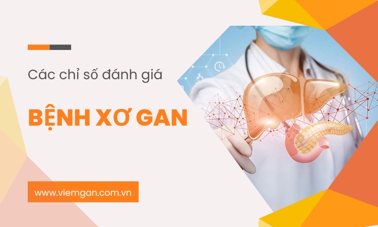 [Điểm danh] các chỉ số đánh giá xơ gan 1