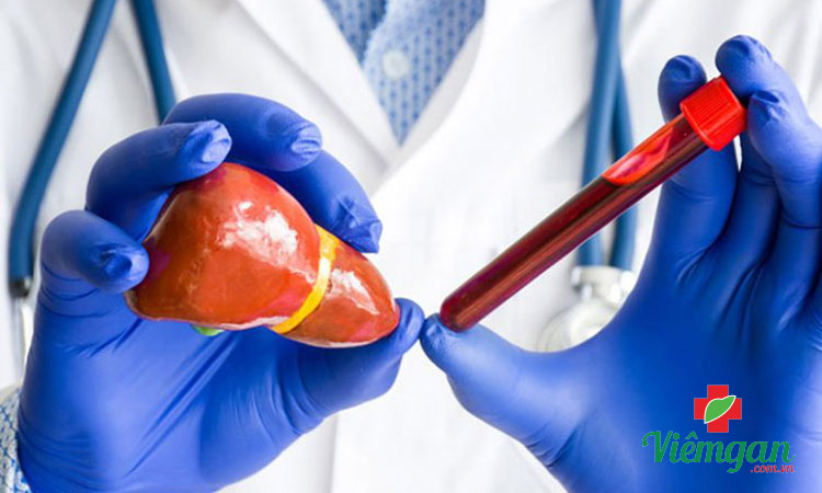 Vai trò của các chỉ số đánh giá xơ gan 1 Vai trò của các chỉ số đánh giá xơ gan 1