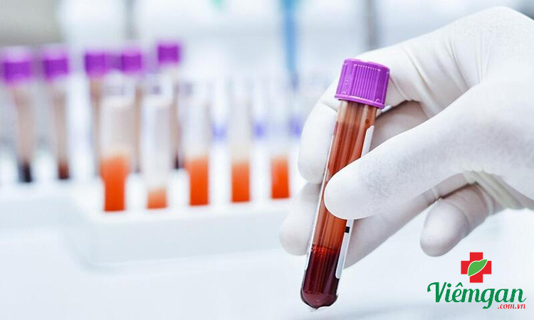 Các chỉ số xét nghiệm chức năng gan 3 Các chỉ số xét nghiệm chức năng gan 3