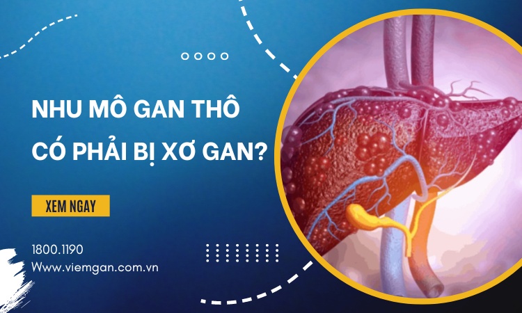 Nhu mô gan thô có phải xơ gan không? 1 Nhu mô gan thô có phải xơ gan không? 1