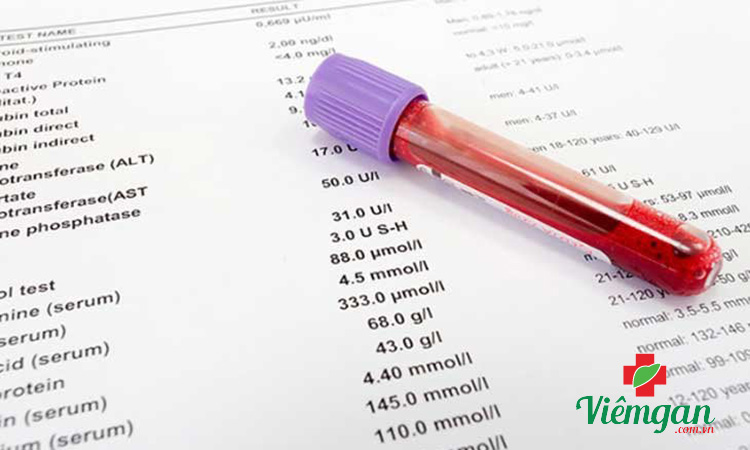 Các chỉ số xét nghiệm công thức máu 1 Các chỉ số xét nghiệm công thức máu 1