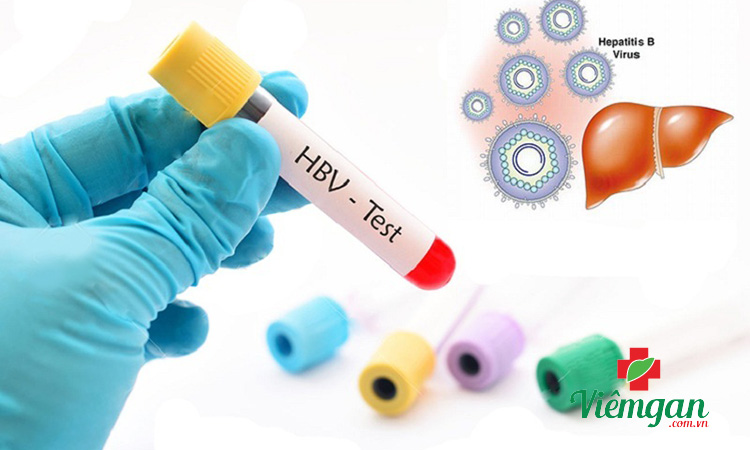 Các chỉ số xét nghiệm máu viêm gan 1 Các chỉ số xét nghiệm máu viêm gan 1