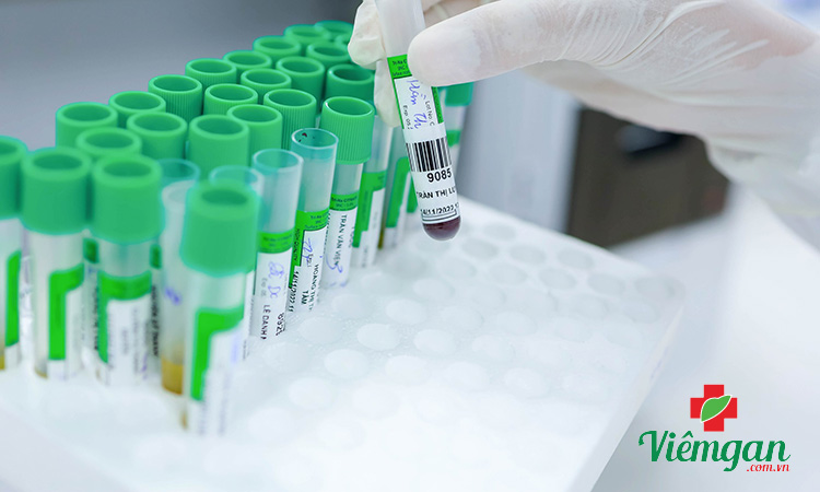 Các chỉ số xét nghiệm đông máu 1 Các chỉ số xét nghiệm đông máu 1